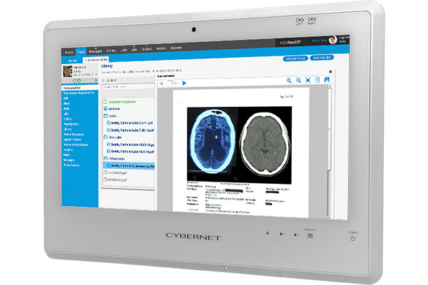 CyberMed S20 Left Angle Thumbnail